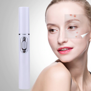 Gadgets d'Eve NOACNE™ : Laser Anti-Acne Avec "Lumiere Bleue"